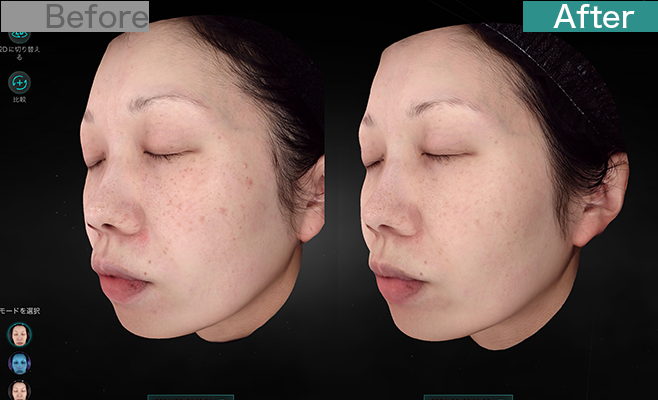 症例紹介の画像